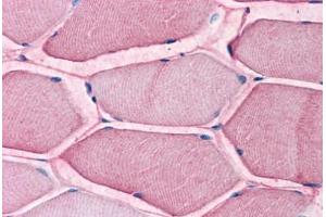 Human Skeletal Muscle: Formalin-Fixed, Paraffin-Embedded (FFPE) (SLC1A5 antibody  (Internal Region))
