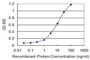 Detection limit for recombinant GST tagged DYX1C1 is 0. (DYX1C1 antibody  (AA 336-420))