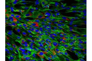 Immunofluorescence (Cultured Cells) (IF (cc)) image for anti-Vimentin (VIM) (AA 371-466) antibody (ABIN672786)