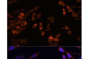 Immunofluorescence analysis of NIH-3T3 cells using PSMB7 Polyclonal Antibody at dilution of 1:100 (40x lens). (PSMB7 antibody)