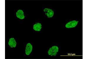 Immunofluorescence of monoclonal antibody to NHLH2 on HeLa cell. (NHLH2 antibody  (AA 36-135))