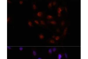 Immunofluorescence analysis of U2OS cells using HOXA2 Polyclonal Antibody at dilution of 1:100. (HOXA2 antibody)