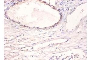 Immunohistochemistry of paraffin-embedded human prostate using BMP2 antibody at dilution of 1:100. (BMP2 antibody  (FITC))