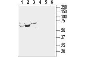 Western blot analysis of rat liver lysate (lanes 1 and 4), mouse liver lysate (lanes 2 and 5) and rat kidney membranes (lanes 3 and 6): - 1-3.
