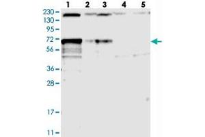 Western blot analysis of Lane 1: RT-4, Lane 2: U-251 MG, Lane 3: Human Plasma, Lane 4: Liver, Lane 5: Tonsil with LTV1 polyclonal antibody  at 1:250-1:500 dilution. (LTV1 antibody)