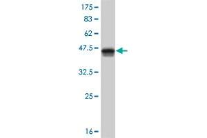 Western Blot detection against Immunogen (37. (HOXB1 antibody  (AA 101-210))