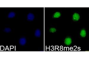 Immunofluorescence analysis of 293T cells using Symmetric DiMethyl-Histone H3-R8 antibody (ABIN3016056, ABIN3016057, ABIN3016058, ABIN1680222 and ABIN6219535). (Histone 3 antibody  (H3R8me2))