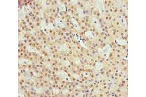 Immunohistochemistry of paraffin-embedded human adrenal gland tissue using ABIN7151117 at dilution of 1:100 (RFFL antibody  (AA 1-190))
