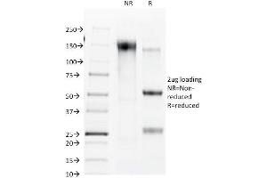 SDS-PAGE Analysis Purified Connexin 32 Mouse Monoclonal Antibody (R5. (GJB1 antibody)