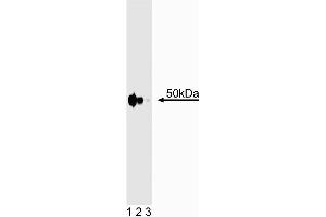 Western blot analysis of ILK on Hs68 cell lysate. (ILK antibody  (AA 326-452))