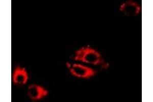 Immunofluorescent analysis of LTA4H staining in Hela cells.