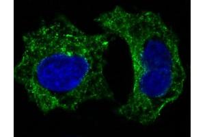 Immunofluorescent analysis of Hela cells, using GSK3 beta Antibody . (Recombinant GSK3 beta antibody)