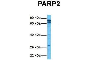 Host:  Rabbit  Target Name:  P Sample Tissue:  Human Hela  Antibody Dilution:  1. (PARP2 antibody  (Middle Region))