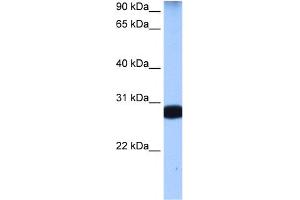 WB Suggested Anti-STAU1 Antibody Titration:  0. (STAU1/Staufen antibody  (N-Term))