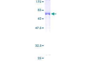 C17orf75 Protein (AA 1-396) (GST tag)