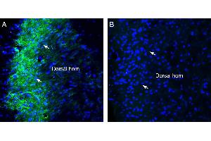 anti-sigma Non-Opioid Intracellular Receptor 1 (SIGMAR1) (AA 113-126), (Intracellular) antibody