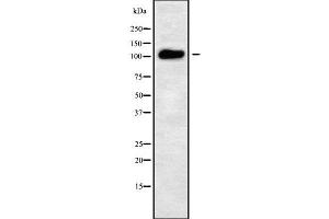 Western blot analysis of ATP2C2 using LOVO whole cell lysates (ATP2C2 antibody  (Internal Region))