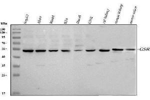 Western blot analysis of Glutathione Reductase using anti-Glutathione Reductase antibody (ABIN5693151). (Glutathione Reductase antibody  (AA 256-522))