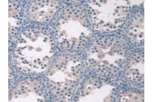 Immunohistochemistry (Paraffin-embedded Sections) (IHC (p)) image for anti-Fibroblast Activation Protein, alpha (FAP) (AA 542-761) antibody (ABIN2929221)