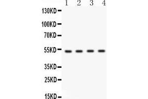 Western blot analysis of BDKRB2 expression in HELA whole cell lysates ( Lane 1), HEPG2 whole cell lysates ( Lane 2), MCF-7 whole cell lysates ( Lane 3) and A549 whole cell lysates ( Lane 4). (BDKRB2 antibody  (C-Term))
