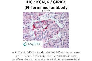 Image no. 1 for anti-Potassium Inwardly-Rectifying Channel, Subfamily J, Member 6 (KCNJ6) (N-Term) antibody (ABIN1736184) (KCNJ6 antibody  (N-Term))