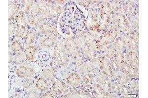 Paraformaldehyde-fixed, paraffin embedded rat kidney tissue, Antigen retrieval by boiling in sodium citrate buffer(pH6) for 15min, Block endogenous peroxidase by 3% hydrogen peroxide for 30 minutes, Blocking buffer (normal goat serum) at 37°C for 20min, Antibody incubation with Rabbit Anti-FCAR Polyclonal Antibody, Unconjugated  at 1:500 overnight at 4°C, followed by a conjugated secondary and DAB staining (FCAR antibody  (AA 131-230))