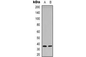 Western blot analysis of Syntaxin 1A (pS14) expression in Hela (A), mouse brain (B) whole cell lysates.