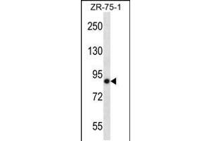 Western blot analysis in ZR-75-1 cell line lysates (35ug/lane). (LRRN4 antibody  (C-Term))