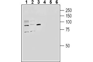 Angiotensin I Converting Enzyme 2 (ACE2) peptide