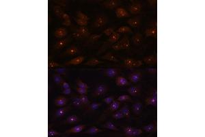 Immunofluorescence analysis of C6 cells using RNA antibody (ABIN7269981) at dilution of 1:100. (RNASEH2A antibody  (AA 1-299))