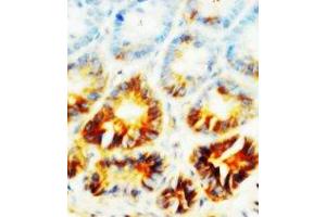 Image no. 1 for anti-Alkaline Phosphatase, Liver/bone/kidney (ALPL) (N-Term) antibody (ABIN1495053)