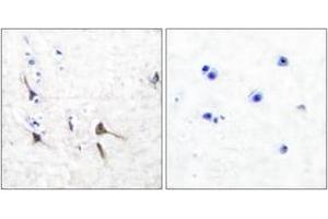 Immunohistochemistry analysis of paraffin-embedded human brain tissue, using Potassium Channel Kv3. (Kv3.2b Potassium Channel antibody  (AA 589-638))