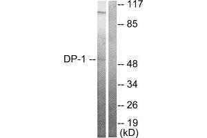 Western Blotting (WB) image for anti-Transglutaminase 4 (Prostate) (TGM4) (C-Term) antibody (ABIN6299265)