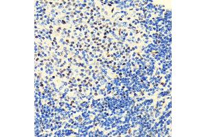 Immunohistochemistry of paraffin-embedded rat spleen using HD antibody (ABIN7267708) at dilution of 1:100 (40x lens). (HDAC2 antibody)
