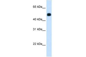 HMGCS2 antibody used at 1. (HMGCS2 antibody)