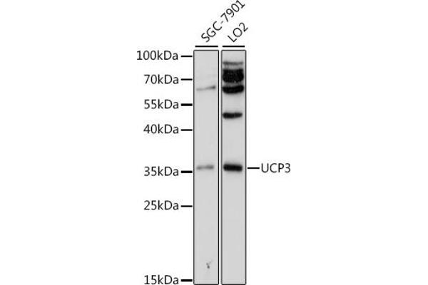 UCP3 antibody  (AA 1-110)