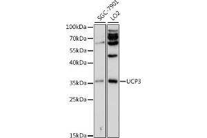 Western blot analysis of extracts of various cell lines, using UCP3 antibody (ABIN3022085, ABIN3022086, ABIN3022087, ABIN1513663 and ABIN6218600) at 1:500 dilution. (UCP3 antibody  (AA 1-110))