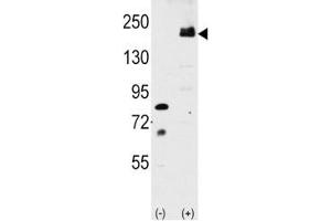 Western blot analysis of LRP6 antibody and 293 cell lysate either nontransfected or transiently transfected with the LRP6 gene. (LRP6 antibody  (AA 1531-1560))