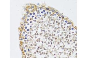 Immunohistochemistry of paraffin-embedded Rat testis using C12orf10 Polyclonal Antibody at dilution of 1:100 (40x lens). (C12orf10 antibody)