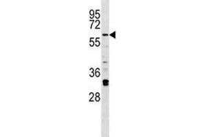 Irak2 antibody western blot analysis in A375 lysate. (IRAK2 antibody  (AA 594-622))