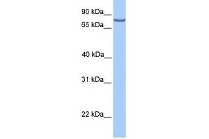 LCA5 antibody used at 1 ug/ml to detect target protein. (LCA5 antibody  (N-Term))