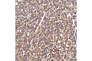 IHC analysis of SCO1 using anti-SCO1 antibody (ABIN7600609). (SCO1 antibody  (AA 21-301))