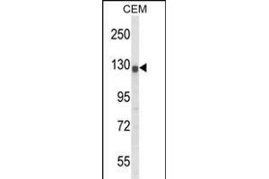 Western blot analysis of KCNH2 Antibody (Center) (ABIN652759 and ABIN2842499) in CEM cell line lysates (35 μg/lane). (KCNH2 antibody  (AA 861-888))