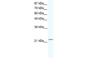 WB Suggested Anti-RGS10 Antibody   Titration: 1. (RGS10 antibody  (Middle Region))