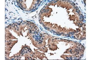 Immunohistochemical staining of paraffin-embedded Human liver tissue using anti-PANK2 mouse monoclonal antibody.