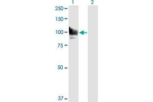 Western Blot analysis of STAT6 expression in transfected 293T cell line by STAT6 monoclonal antibody (M01A), clone 6C10. (STAT6 antibody  (AA 694-801))
