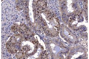 IHC analysis of FEN1 using anti-FEN1 antibody (ABIN7601618).