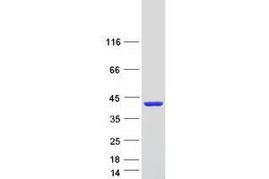 Calcium Binding Protein 39-Like (CAB39L) (Transcript Variant 2) protein (Myc-DYKDDDDK Tag)