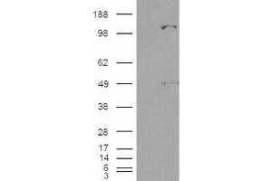 Western Blotting (WB) image for anti-Pyruvate Carboxylase (PC) (Internal Region) antibody (ABIN2466170) (PC antibody  (Internal Region))