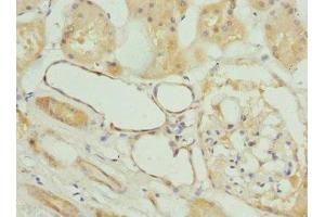 FXYD5 antibody  (AA 22-145)